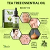 Product: Kalp Pack Of 03 Essential oils Orange, Tea Tree, Rosemary- 15ml Each
